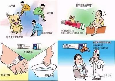 男子去洗浴中心染上疾病,男子去洗脚感染脚气