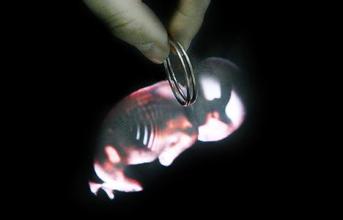 上环是不是对身体伤害很大啊,上环的危害和好处