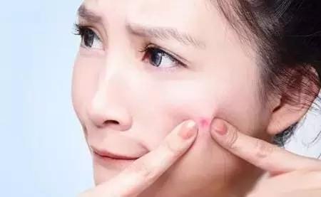 祛痘痘血泪史养生篇,战痘美妆博主