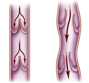 李玉华西医诊所,丹东张爱华治疗静脉曲张