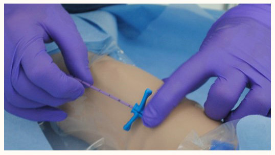 超声引导下改良塞丁格技术解剖图,超声引导下pdca置管