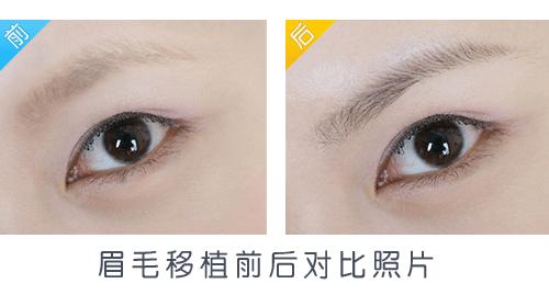 眉毛有哪几种整形,眉部修饰的技巧