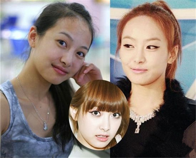 脑门大的露额头显得头大！来学学明星是如何解决的！