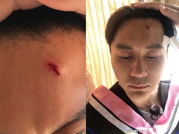 范冰冰祛疤膏,著名美妆博主范冰冰