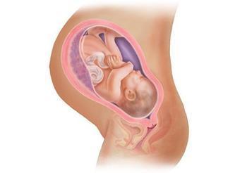 产后阴道松弛苦恼多如何改善