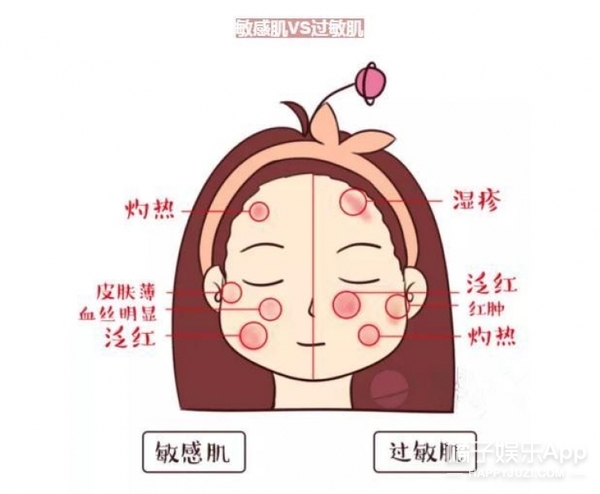 敏感肌脸发烫怎么快速解决,敏感肌发红发烫是有炎症吗