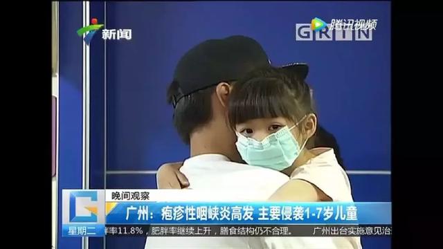 手足口病疱疹性咽峡炎如何防治,疱疹性咽峡炎的防治