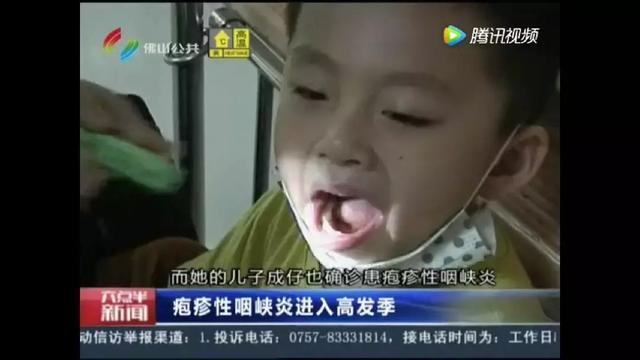 手足口病疱疹性咽峡炎如何防治,疱疹性咽峡炎的防治