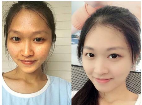 欧宝妍谷胱甘肽,日本谷胱甘肽美白饮推荐