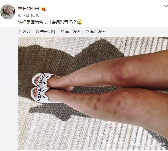 月经期为什么会有淤青,月经期褐红分泌物怎么回事