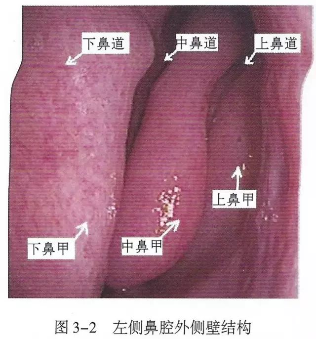 下呼吸道详细图解,必备上呼吸道解剖详解