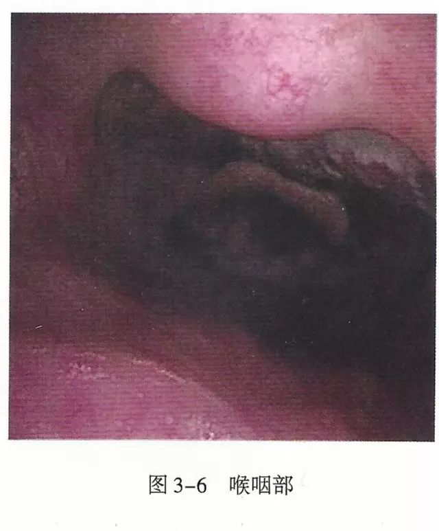 下呼吸道详细图解,必备上呼吸道解剖详解