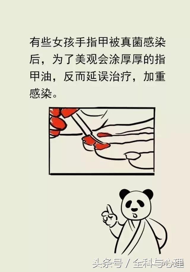 脚气冬天治好还是夏天治疗好,夏天来了脚气提前预防