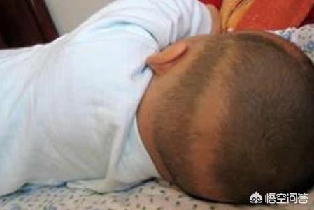 宝宝枕秃就是缺钙吗？医生终于说实话了
