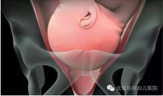 “开十指”是什么意思孕妈们误解了吗?