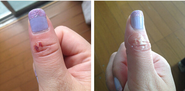 日本哪些汉方药比较好 (日本有什么最值得买的药)