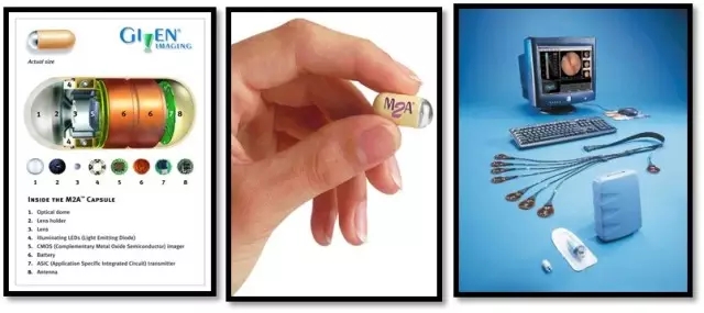 消化道胶囊内镜,胶囊内镜可以看到全部消化道吗