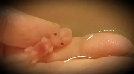 有没有前两次流产第三次成功的,做了一次流产又自然流产一次