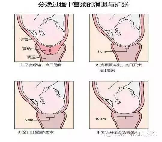 “开十指”是什么意思孕妈们误解了吗?