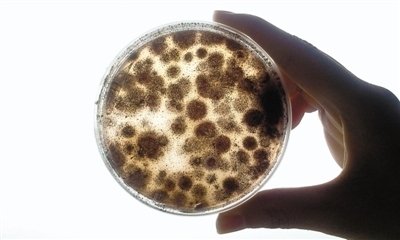 霉菌性阴道炎怎么老治不好？