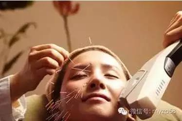 美容师针清手法,美容针手法