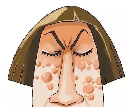 祛痘妙招生理期痘痘治疗方法