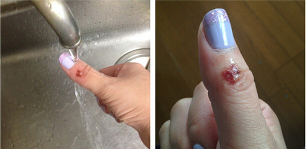 日本哪些汉方药比较好 (日本有什么最值得买的药)