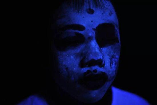 16岁男孩用祛斑面膜变阿凡达这些牌子都被曝光过