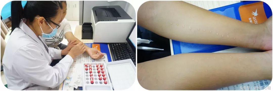 世界过敏性日知识你知道吗,世界过敏日科普视频