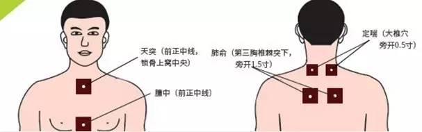 西苑中医医院三伏鼻炎贴位置,西苑医院三伏贴儿科