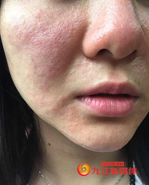 鑴搁儴缇庡姣佸,缇庡鑴歌姣佸