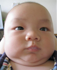 小孩口吐白沫抽搐在医院怎么办,孩子口吐白沫怎么回事