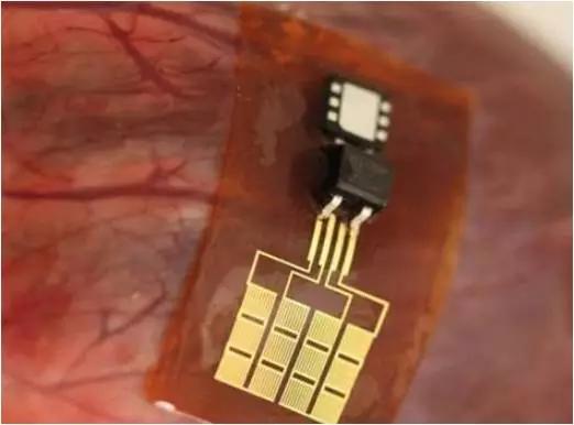 机械模拟正常心跳：新型纳米材料“心脏电网”