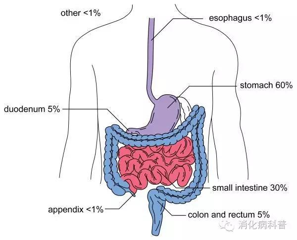 胃肠间质瘤中药治疗方法,胃肠间质瘤复发能活多久