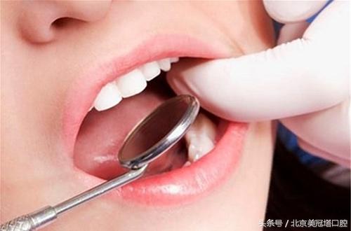 顽固性牙菌斑怎么解决,5分钟内消除牙菌斑的6种有效方法