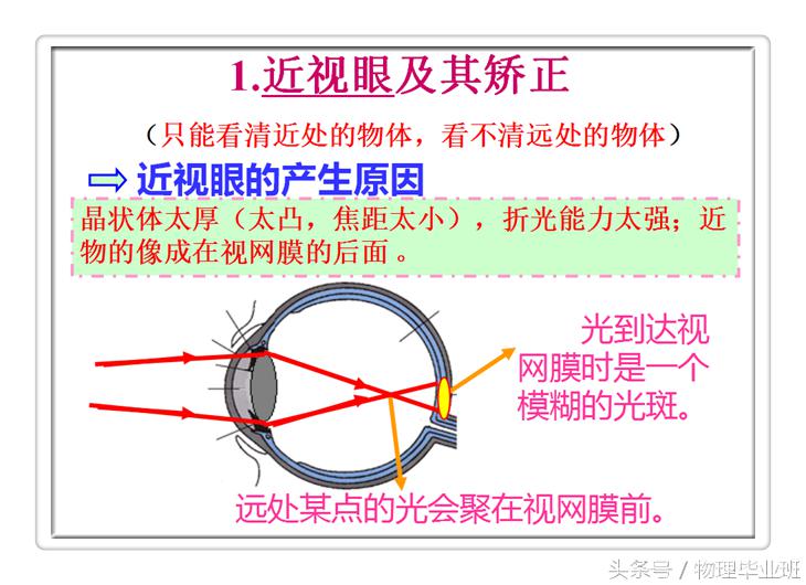 近视眼和远视眼的物理图片大全,物理近视眼远视眼的成因及矫正图