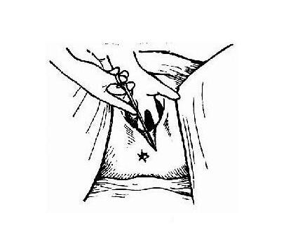 产后顺产妈妈要注意什么问题,侧切妈妈怎么恢复