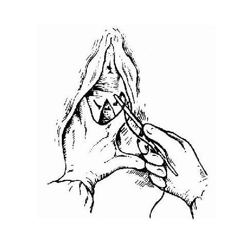 产后顺产妈妈要注意什么问题,侧切妈妈怎么恢复