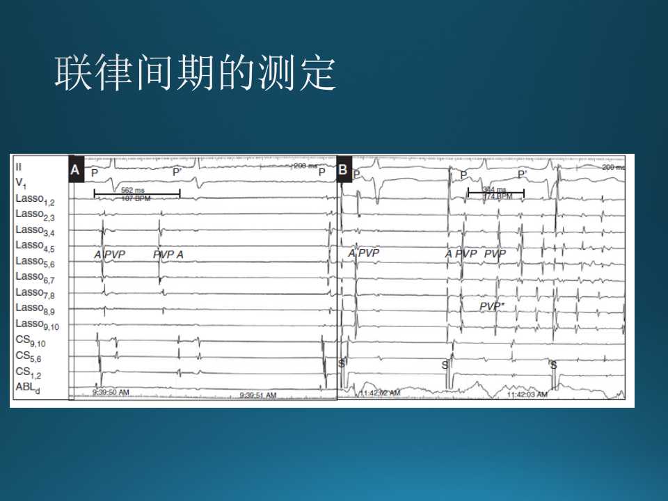 仁济医院射频消融王新华,王新华主要事迹