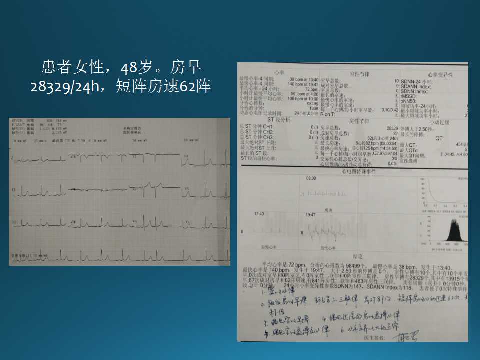 仁济医院射频消融王新华,王新华主要事迹