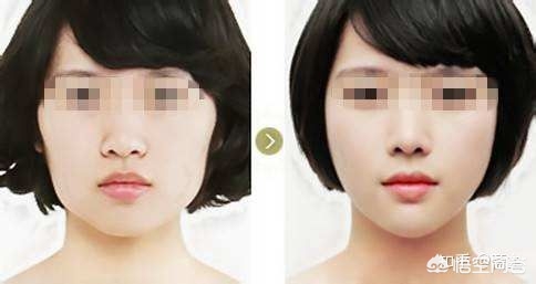 咬肌型大脸怎么瘦下来,圆方脸咬肌大怎么瘦脸