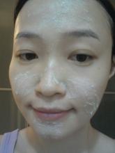 痘痘肌怎么去粉刺闭口,痘痘肌怎么去螨虫