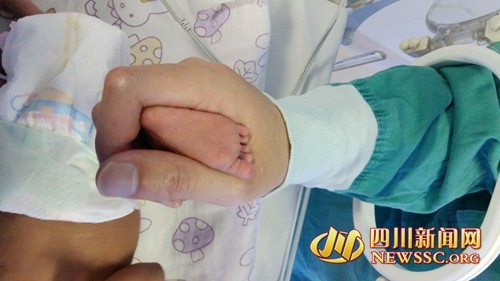 眉山30周早产儿,四川省医院早产儿救治率