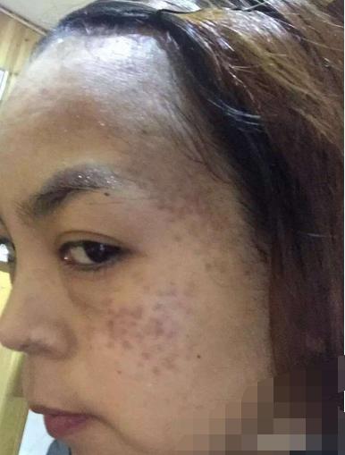 肌肤美白的方法,美白小秘诀