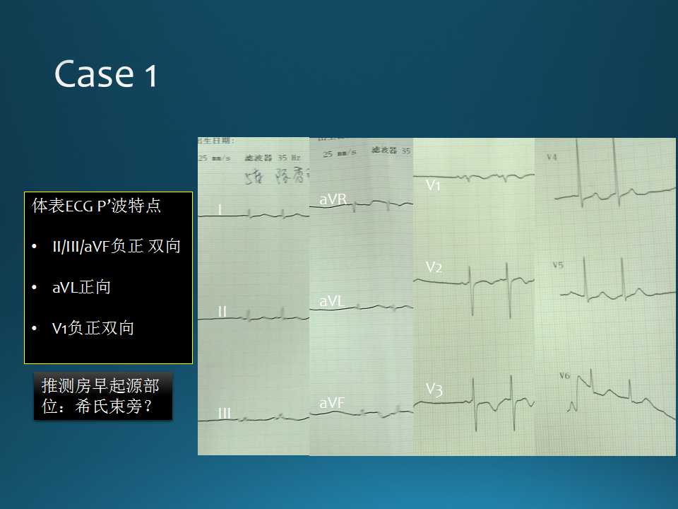 仁济医院射频消融王新华,王新华主要事迹