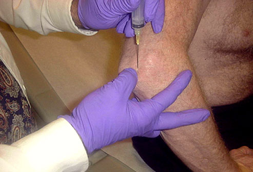 痛风的原因是什么临床是如何治疗,手指痛风的症状和治疗