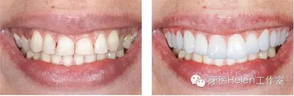 helen榻跨榛勭拹,helen鐗欑