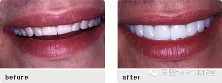 helen榻跨榛勭拹,helen鐗欑