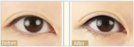 天津美莱年中盛典,天津美莱医学美容旗舰店