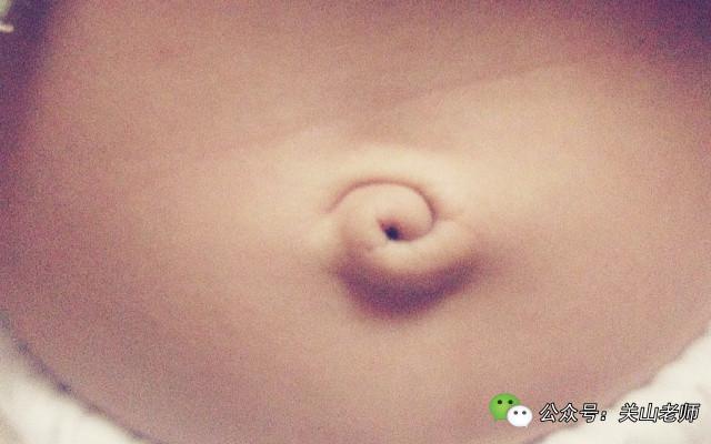 一哭就鼓起来并伴有咕咕声的肚脐，你家宝宝出现了吗？